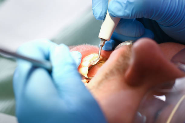 Best Emergency Care for Gum Disease in Tuckahoe, NY