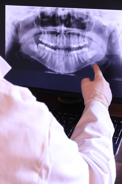 Best Emergency Root Canal Therapy in Tuckahoe, NY